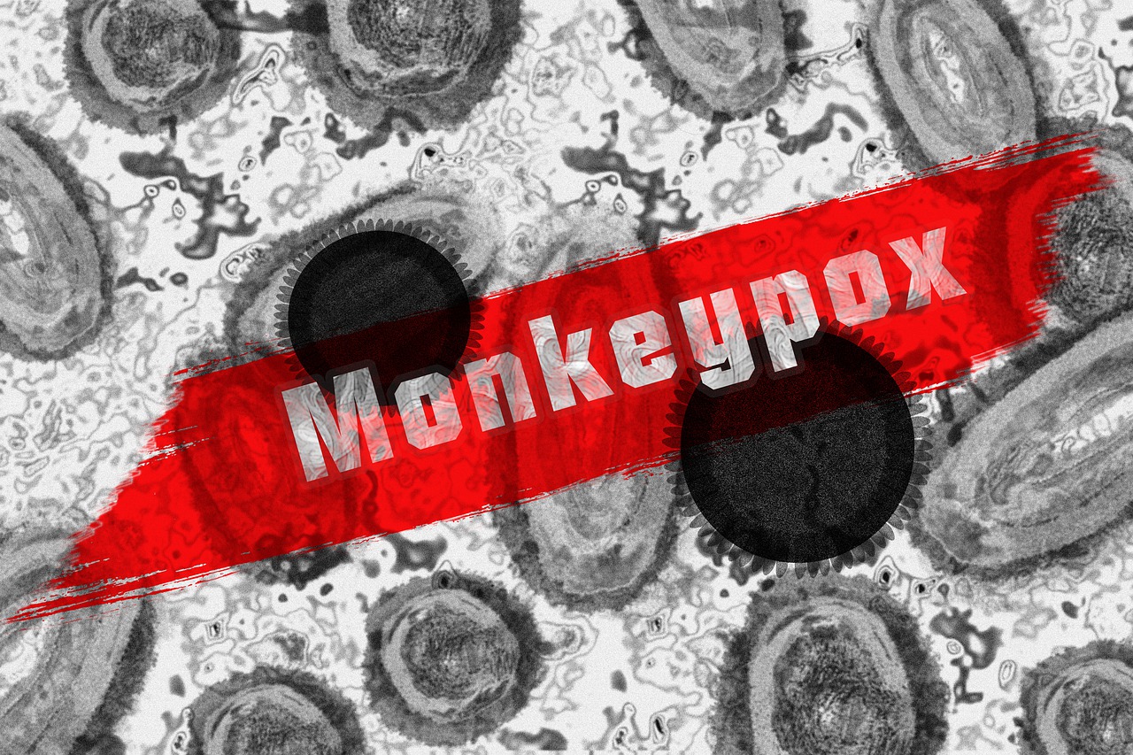 Monkeypox Virus